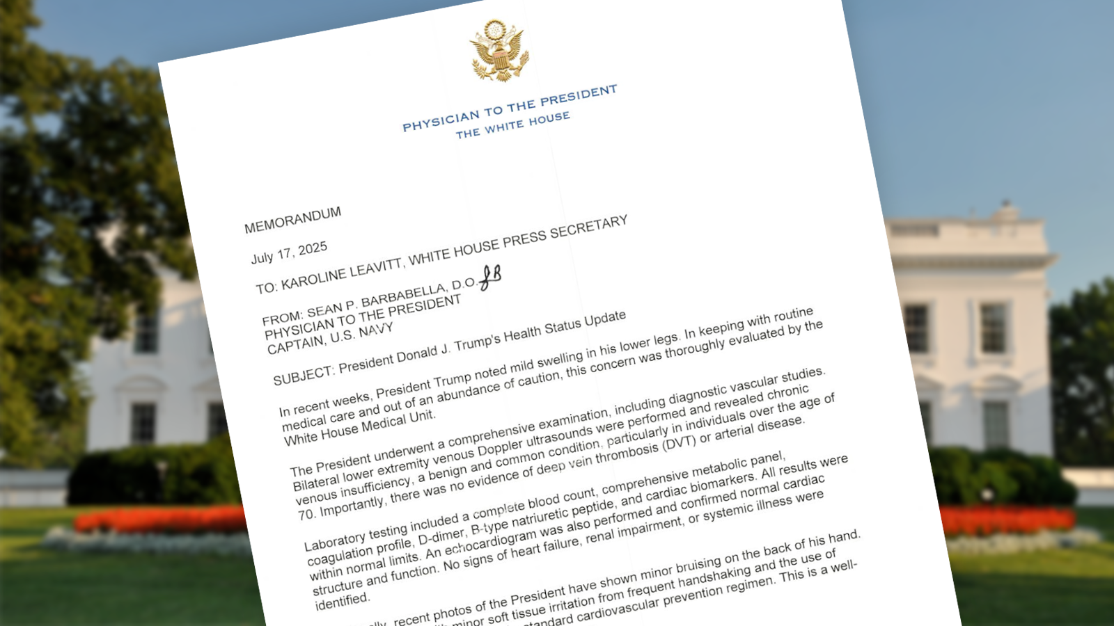 President Trump's CVI Diagnosis: Insights on Circulation Challenges and Natural Support for Healthy Blood Flow